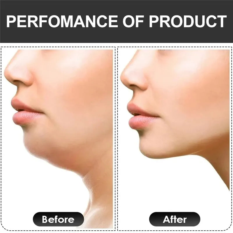 Ejercitador de Mandíbula Forma U - Pop N Go Facial | Jawline Fitness Chew Ball | Entrenador Muscular de Mordida